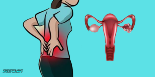 Early warning signs of ovarian cancer every woman should know