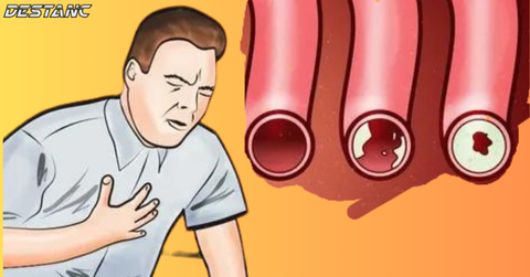 Here are 7 warning signs that indicate clogged arteries.