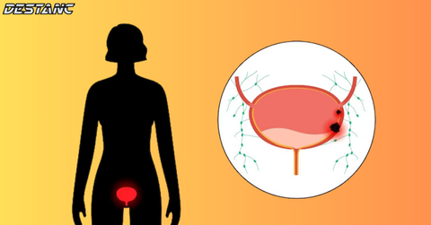 6 warning signs of bladder cancer